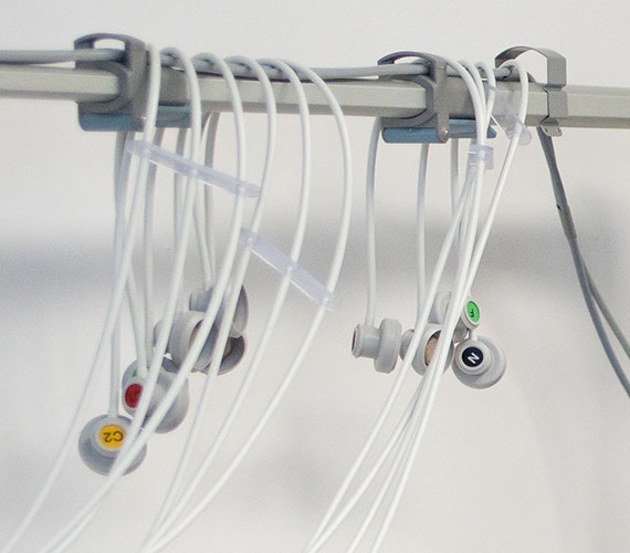 ekg